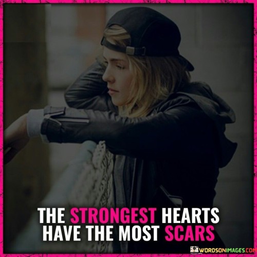 The-Strongest-Hearts-Have-The-Most-Scars-Quotes.jpeg