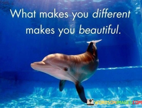 What-Makes-You-Different-Makes-You-Beautiful-Quotes.jpeg