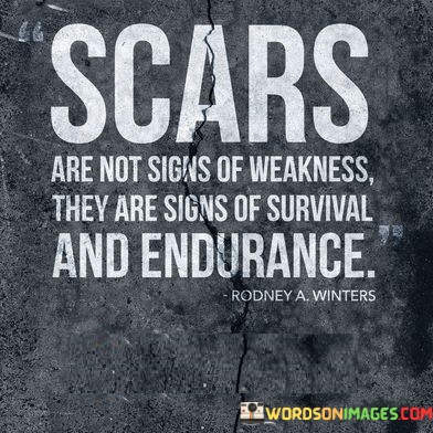 Scars Are Not Sign Of Weakness They Are Sign Quotes