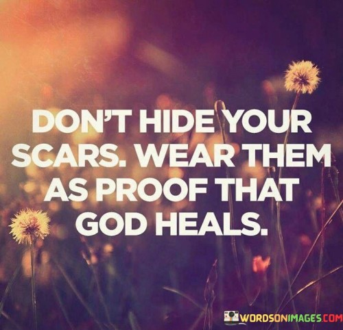 Dont-Hide-Your-Scars-Wear-Them-As-Proof-That-God-Quotes.jpeg