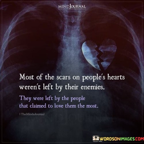 Most-Of-The-Scars-On-Peoples-Hearts-Werent-Quotes.jpeg