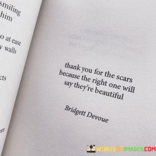 Thank You For The Scars Because The Right One Will Quotes